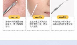 暗疮针去黑头 视频,轻松告别顽固黑头