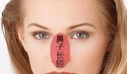 挤鼻子粉刺视频,专业技巧与注意事项