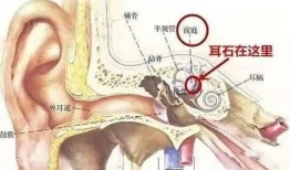 耳石症眩晕怎么办最快最有效视频,视频教程详解