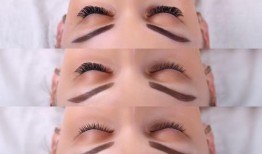 用激光洗眉毛视频,轻松告别浓眉烦恼，焕然一新