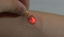 人体芯片的真相视频,真相与争议并存